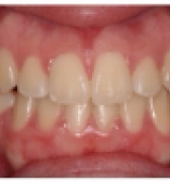 After care from Dr. Sussman and Dr. Pogal at the Center for Cosmetic Dentistry