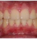 A patient after care from the Center for Cosmetic Dentistry